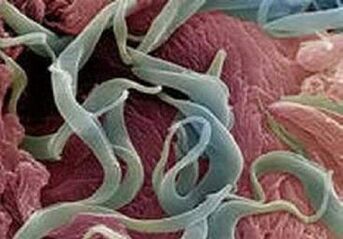 Simptomi i liječenje parazita u ljudskom tijelu