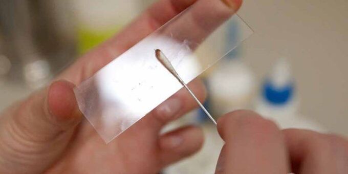 struganje kože za parazite