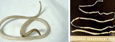 Vrste parazita u ljudskom tijelu