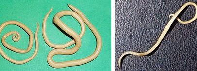 koje parazite čovjek može imati