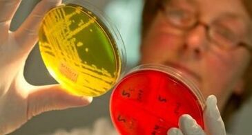 dijagnoza parazita u tijelu